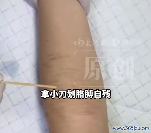 高三女生高考前表白被拒自残住院 大夫判断：是失恋导致的情怀波动和自我怀疑